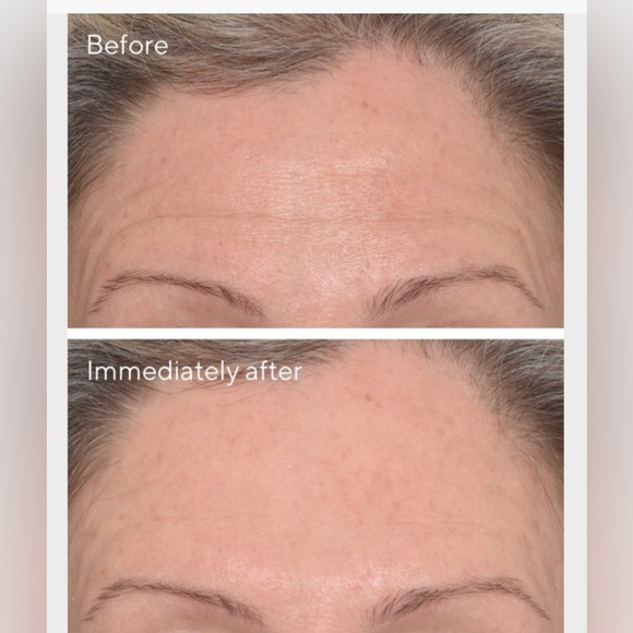 Murad Targeted Wrinkle Corrector - Picture 4 of 5